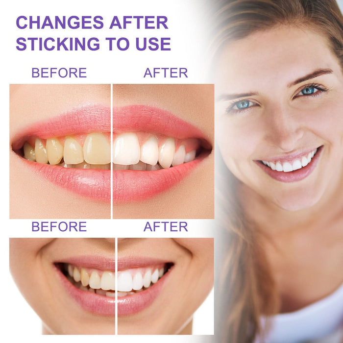 Teeth Whitening Toothpaste